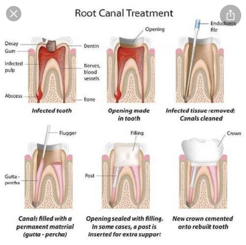 FOCUZ DENTAL CARE PAYYOLI